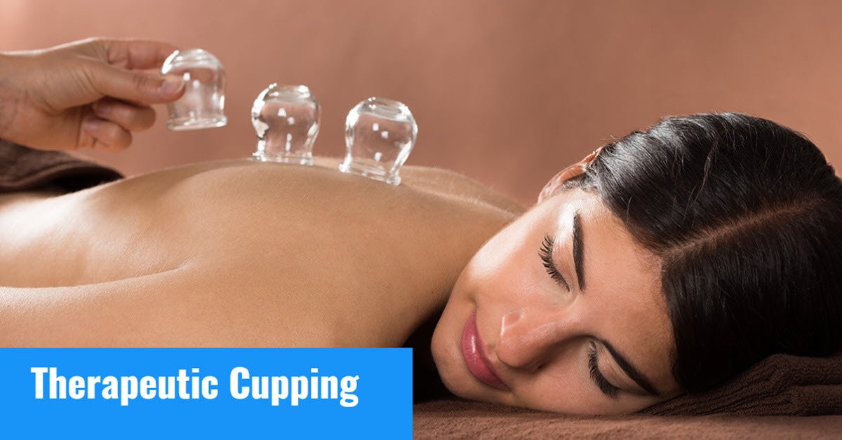 therapeutic cupping therapy